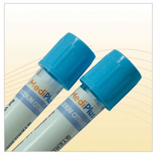 Sodium Citrate Tubes - Blood Collection Tube. Sodium Citrate Tubes